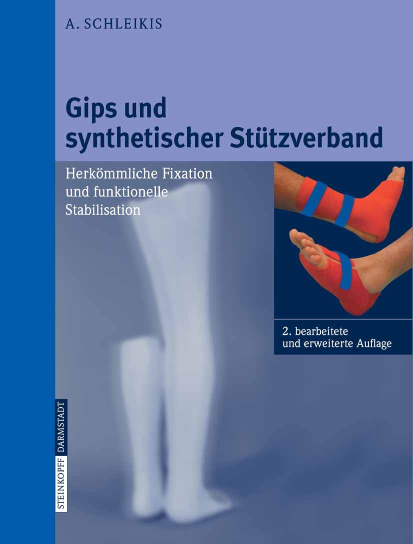 Titlebook: Gips und synthetischer Stützverband; Herkömmliche Fixatio Adolf Schleikis Book 2007Latest edition Steinkopff-Verlag Darmstadt 2007 Chirurgi Titlebook: Gips und synthetischer Stützverband; Herkömmliche Fixatio Adolf Schleikis Book 2007Latest edition Steinkopff-Verlag Darmstadt 2007 Chirurgi