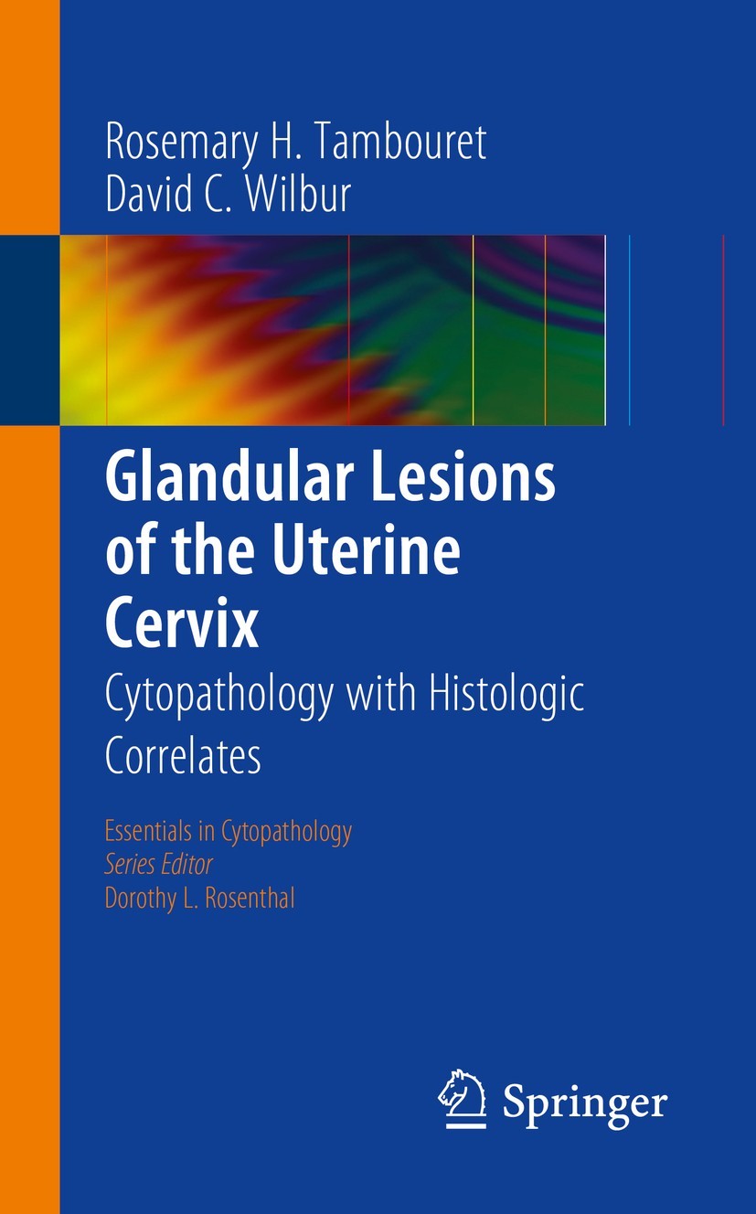 Titlebook: Glandular Lesions of the Uterine Cervix; Cytopathology with H Rosemary H. Tambouret,David C. Wilbur Book 2015 Springer Science+Business Med Titlebook: Glandular Lesions of the Uterine Cervix; Cytopathology with H Rosemary H. Tambouret,David C. Wilbur Book 2015 Springer Science+Business Med
