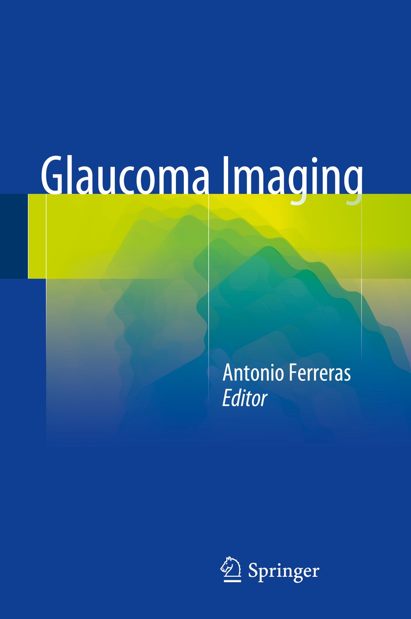 Titlebook: Glaucoma Imaging; Antonio Ferreras Book 2016 Springer International Publishing Switzerland 2016 Gonioscopy.Optical coherence tomography (O Titlebook: Glaucoma Imaging; Antonio Ferreras Book 2016 Springer International Publishing Switzerland 2016 Gonioscopy.Optical coherence tomography (O