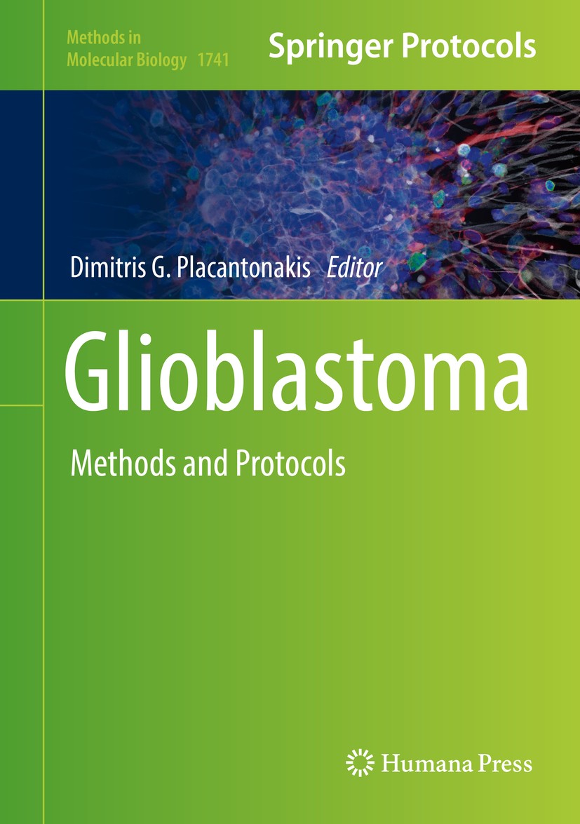 Titlebook: Glioblastoma; Methods and Protocol Dimitris G.‘Placantonakis Book 2018 Springer Science+Business Media, LLC 2018 xenografts.GBM cancer stem Titlebook: Glioblastoma; Methods and Protocol Dimitris G.‘Placantonakis Book 2018 Springer Science+Business Media, LLC 2018 xenografts.GBM cancer stem