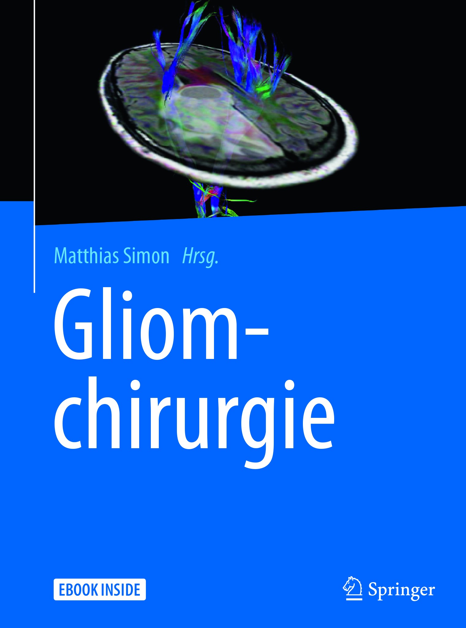Titlebook: Gliomchirurgie; Matthias Simon Book 2018 Springer-Verlag Berlin Heidelberg 2018 Hirntumor.Neuronavigation.Neuroonkologie.Zentralnervensyst Titlebook: Gliomchirurgie; Matthias Simon Book 2018 Springer-Verlag Berlin Heidelberg 2018 Hirntumor.Neuronavigation.Neuroonkologie.Zentralnervensyst