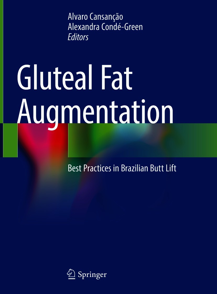 Titlebook: Gluteal Fat Augmentation; Best Practices in Br Alvaro Cansanção,Alexandra Condé-Green Book 2021 Springer Nature Switzerland AG 2021 gluteal Titlebook: Gluteal Fat Augmentation; Best Practices in Br Alvaro Cansanção,Alexandra Condé-Green Book 2021 Springer Nature Switzerland AG 2021 gluteal