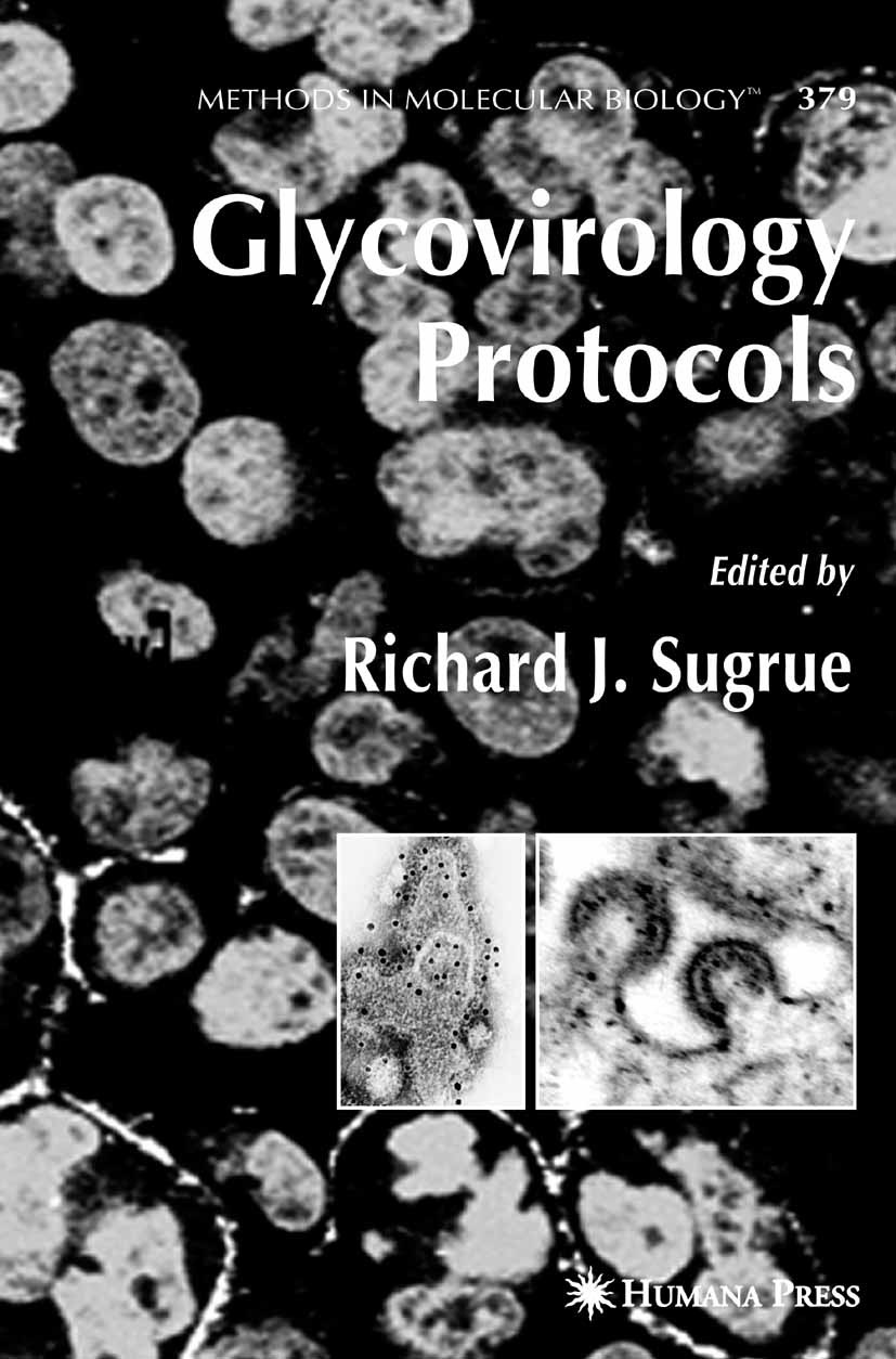 Titlebook: Glycovirology Protocols; Richard J. Sugrue Book 2007 Humana Press 2007 Hepatitis.Polyacrylamid-Gelelektrophorese.antibody.biology.infectio Titlebook: Glycovirology Protocols; Richard J. Sugrue Book 2007 Humana Press 2007 Hepatitis.Polyacrylamid-Gelelektrophorese.antibody.biology.infectio