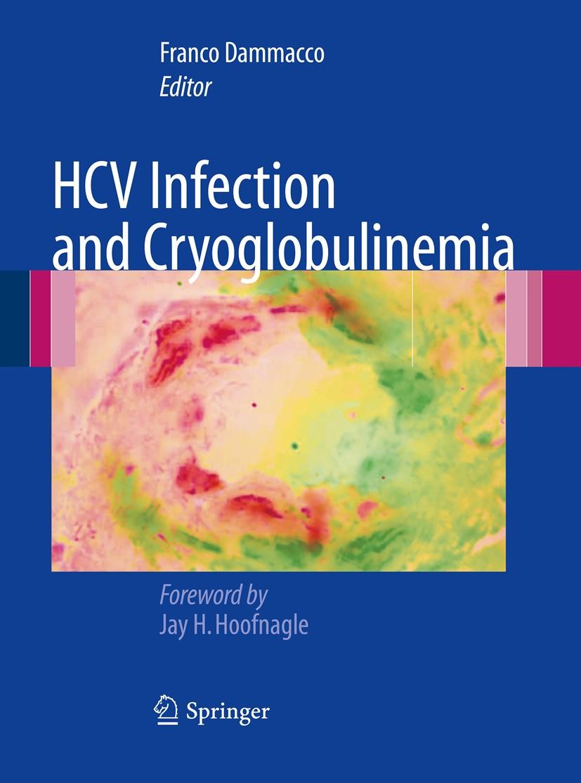 Titlebook: HCV Infection and Cryoglobulinemia; Franco Dammacco Book 20121st edition Springer-Verlag Italia 2012 Autoimmunity.Cryoglobulinemia.HCV.Imm Titlebook: HCV Infection and Cryoglobulinemia; Franco Dammacco Book 20121st edition Springer-Verlag Italia 2012 Autoimmunity.Cryoglobulinemia.HCV.Imm