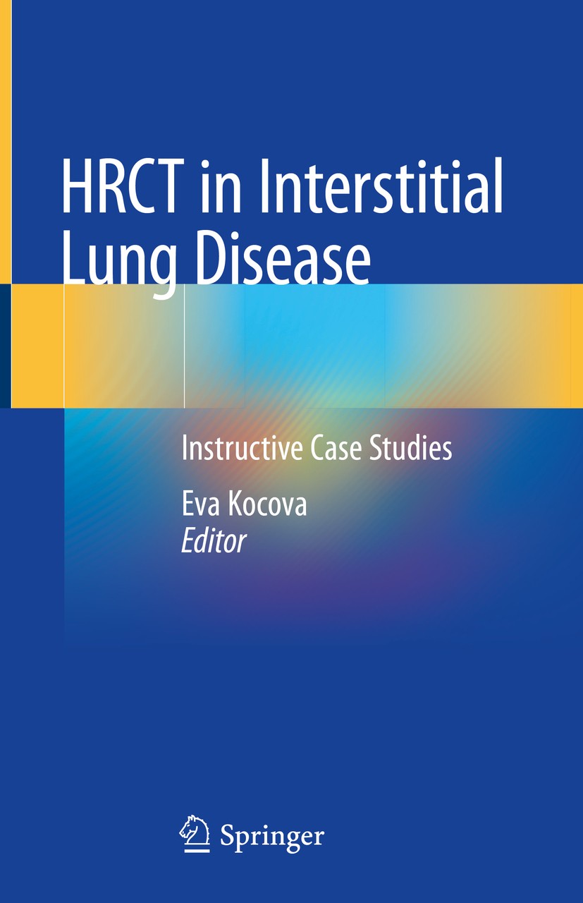 Titlebook: HRCT in Interstitial Lung Disease; Instructive Case Stu Eva Kocova Book 2019 Springer Nature Switzerland AG 2019 Interstitial Lung Disease. Titlebook: HRCT in Interstitial Lung Disease; Instructive Case Stu Eva Kocova Book 2019 Springer Nature Switzerland AG 2019 Interstitial Lung Disease.