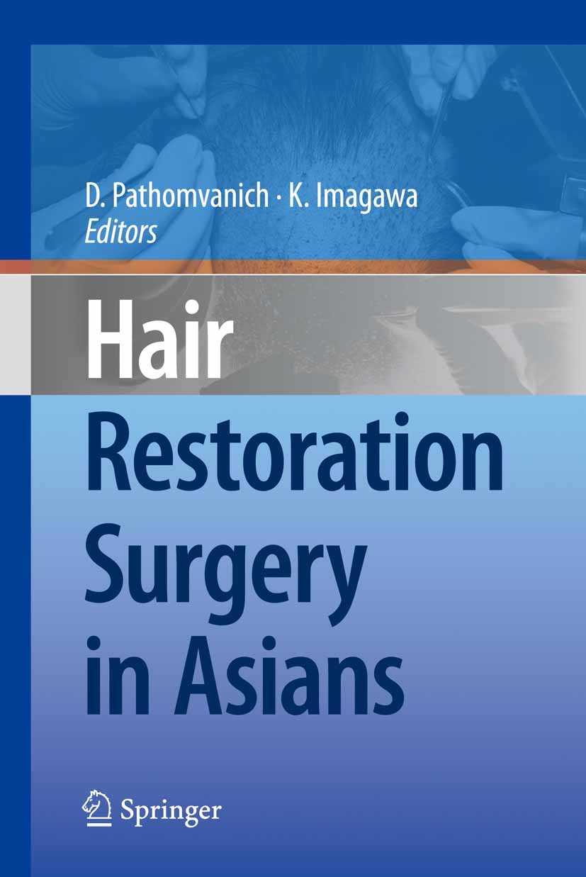 Titlebook: Hair Restoration Surgery in Asians; Damkerng Pathomvanich (Consulting Staff, General H Book 2010 Springer-Verlag Tokyo 2010 Hair Loss.Hair Titlebook: Hair Restoration Surgery in Asians; Damkerng Pathomvanich (Consulting Staff, General H Book 2010 Springer-Verlag Tokyo 2010 Hair Loss.Hair
