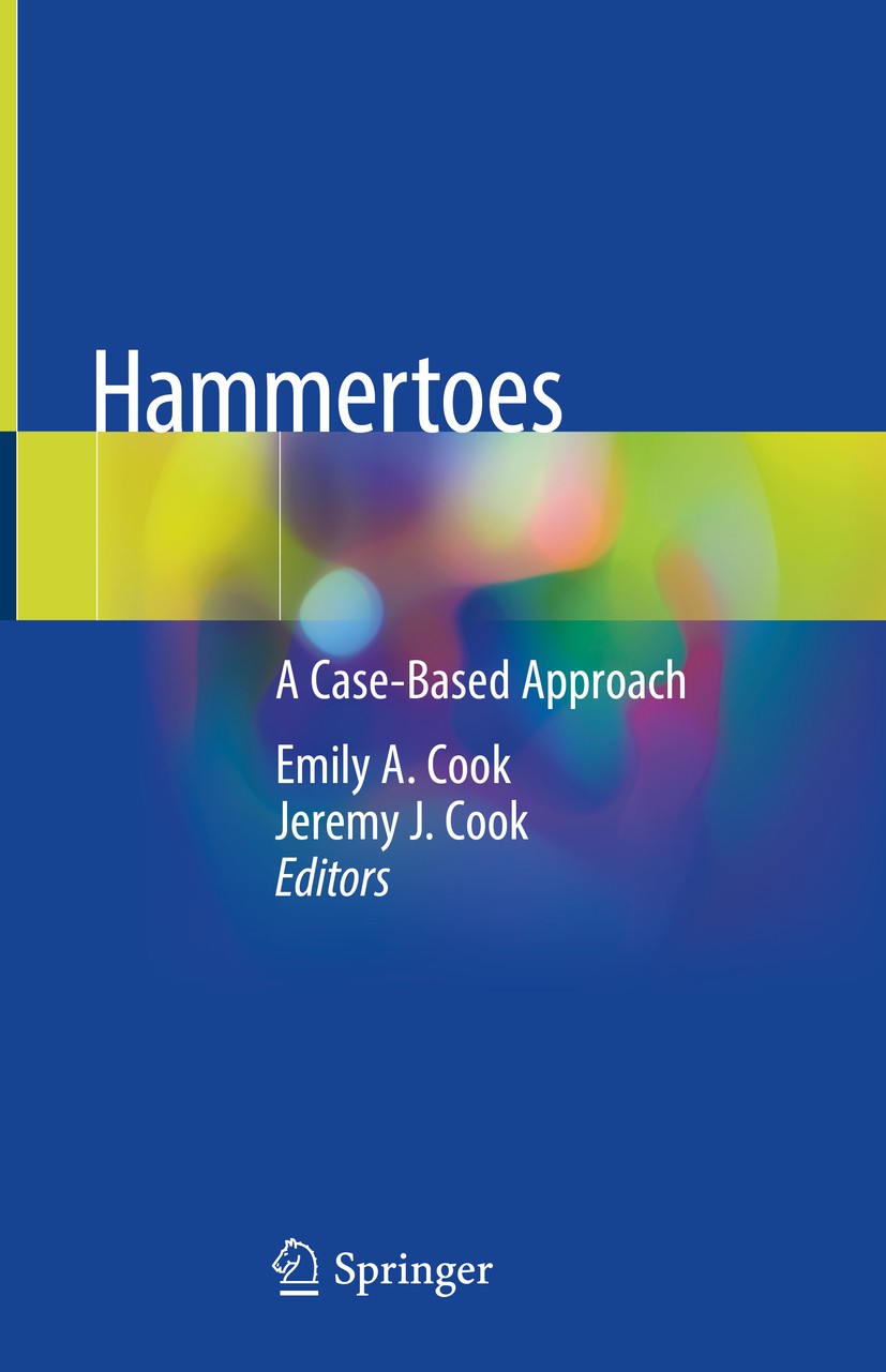 Titlebook: Hammertoes; A Case-Based Approac Emily A. Cook,Jeremy J. Cook Book 2019 Springer Nature Switzerland AG 2019 Allograft implant.Bioabsorbable Titlebook: Hammertoes; A Case-Based Approac Emily A. Cook,Jeremy J. Cook Book 2019 Springer Nature Switzerland AG 2019 Allograft implant.Bioabsorbable