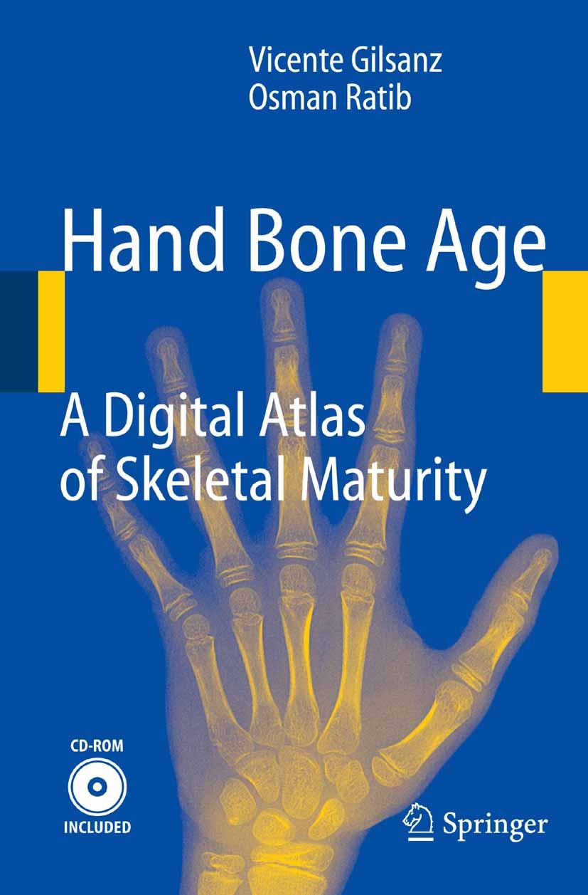 Titlebook: Hand Bone Age; A Digital Atlas of S Vicente Gilsanz,Osman Ratib Book 20051st edition Springer-Verlag Berlin Heidelberg 2005 Bone Maturity.M Titlebook: Hand Bone Age; A Digital Atlas of S Vicente Gilsanz,Osman Ratib Book 20051st edition Springer-Verlag Berlin Heidelberg 2005 Bone Maturity.M