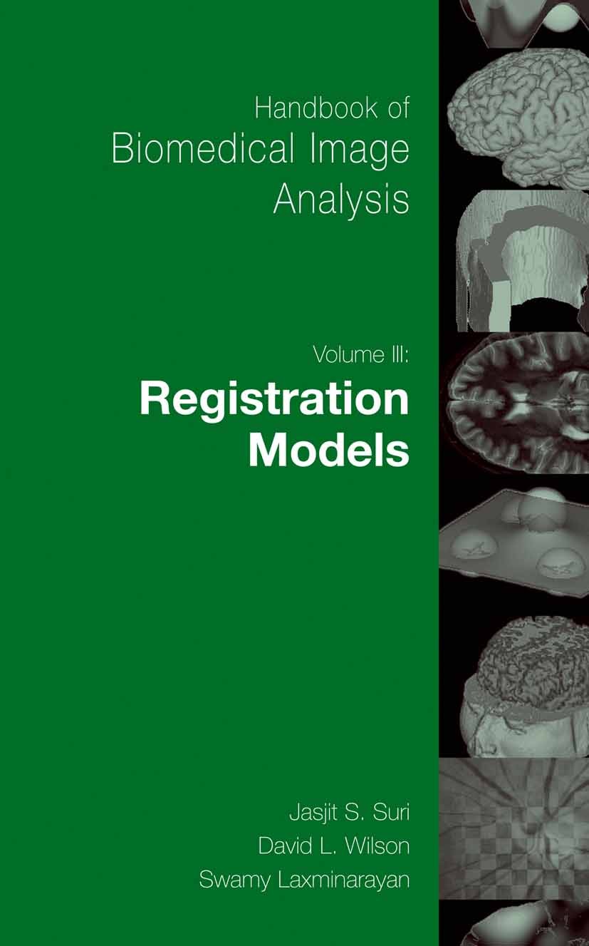 Titlebook: Handbook of Biomedical Image Analysis; Volume 3: Registrati Jasjit S. Suri,David L. Wilson,Swamy Laxminarayan Book 2005 Springer-Verlag US Titlebook: Handbook of Biomedical Image Analysis; Volume 3: Registrati Jasjit S. Suri,David L. Wilson,Swamy Laxminarayan Book 2005 Springer-Verlag US