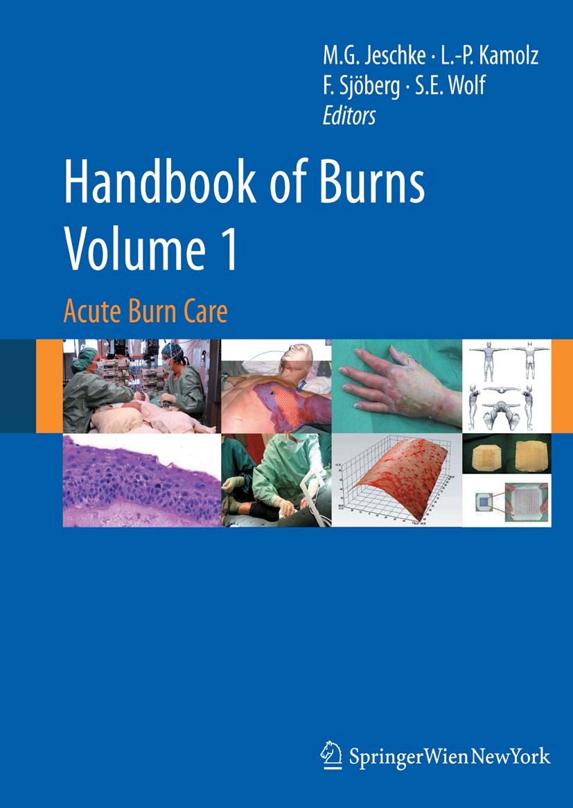 Titlebook: Handbook of Burns Volume 1; Acute Burn Care Marc G. Jeschke,Lars-Peter Kamolz,Steven E. Wolf Book 20121st edition Springer-Verlag/Wien 2012 Titlebook: Handbook of Burns Volume 1; Acute Burn Care Marc G. Jeschke,Lars-Peter Kamolz,Steven E. Wolf Book 20121st edition Springer-Verlag/Wien 2012