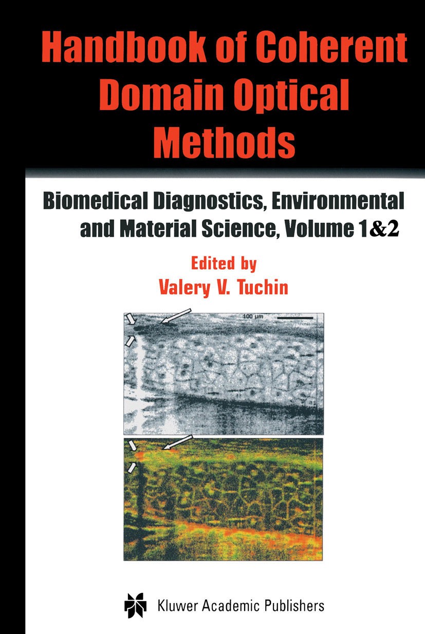 Titlebook: Coherent Domain Optical Methods; Biomedical Diagnosti Valery V. Tuchin Reference work 20041st edition Springer US 2004 Olson.PC170.Tuchin.c Titlebook: Coherent Domain Optical Methods; Biomedical Diagnosti Valery V. Tuchin Reference work 20041st edition Springer US 2004 Olson.PC170.Tuchin.c