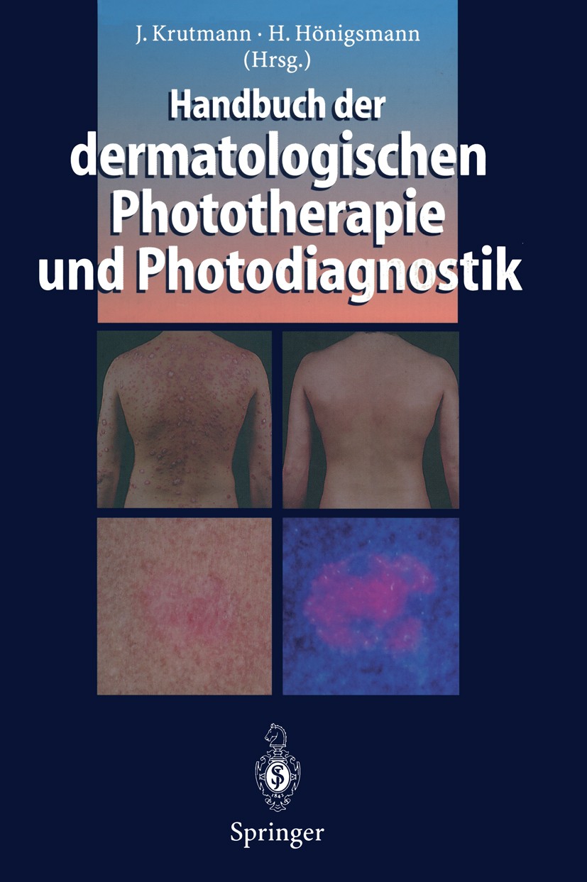 Titlebook: Handbuch der dermatologischen Phototherapie und Photodiagnostik; Jean Krutmann,Herbert Hönigsmann Book 19971st edition Springer-Verlag Ber Titlebook: Handbuch der dermatologischen Phototherapie und Photodiagnostik; Jean Krutmann,Herbert Hönigsmann Book 19971st edition Springer-Verlag Ber