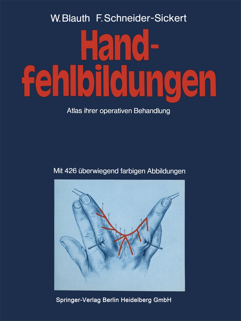 Titlebook: Handfehlbildungen; Atlas ihrer operativ Walter Blauth,Frank R. Schneider-Sickert Book 1976 Springer-Verlag Berlin Heidelberg 1976 Chirurgie Titlebook: Handfehlbildungen; Atlas ihrer operativ Walter Blauth,Frank R. Schneider-Sickert Book 1976 Springer-Verlag Berlin Heidelberg 1976 Chirurgie