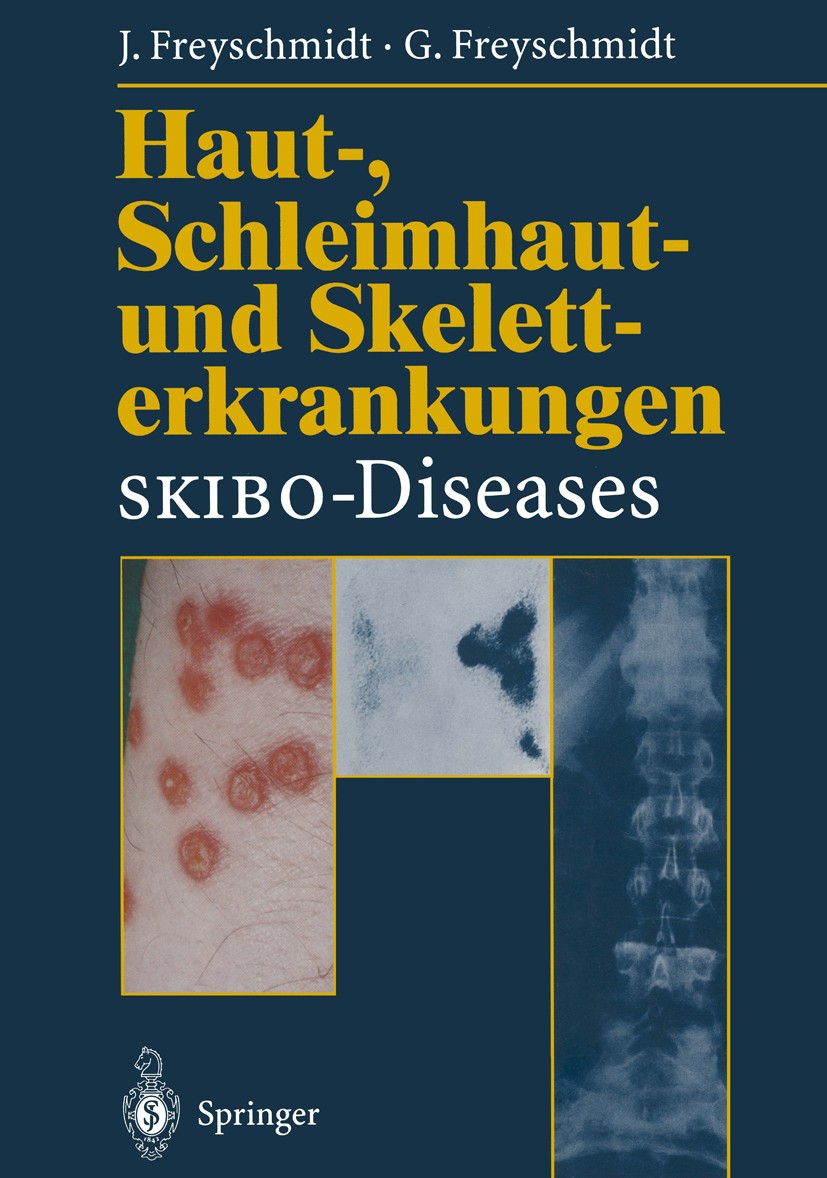 Titlebook: Haut-, Schleimhaut- und Skeletterkrankungen SKIBO-Diseases; Eine dermatologische Jürgen Freyschmidt,Gisela Freyschmidt Book 1996 Springer-V Titlebook: Haut-, Schleimhaut- und Skeletterkrankungen SKIBO-Diseases; Eine dermatologische Jürgen Freyschmidt,Gisela Freyschmidt Book 1996 Springer-V