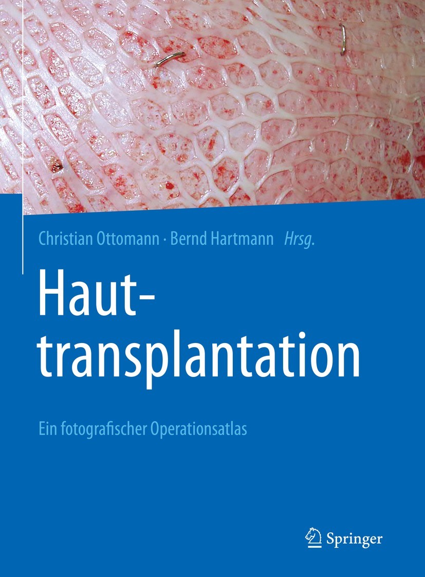 Titlebook: Hauttransplantation; Ein fotografischer O Christian Ottomann,Bernd Hartmann Book 2022 Springer-Verlag GmbH Deutschland, ein Teil von Spring Titlebook: Hauttransplantation; Ein fotografischer O Christian Ottomann,Bernd Hartmann Book 2022 Springer-Verlag GmbH Deutschland, ein Teil von Spring