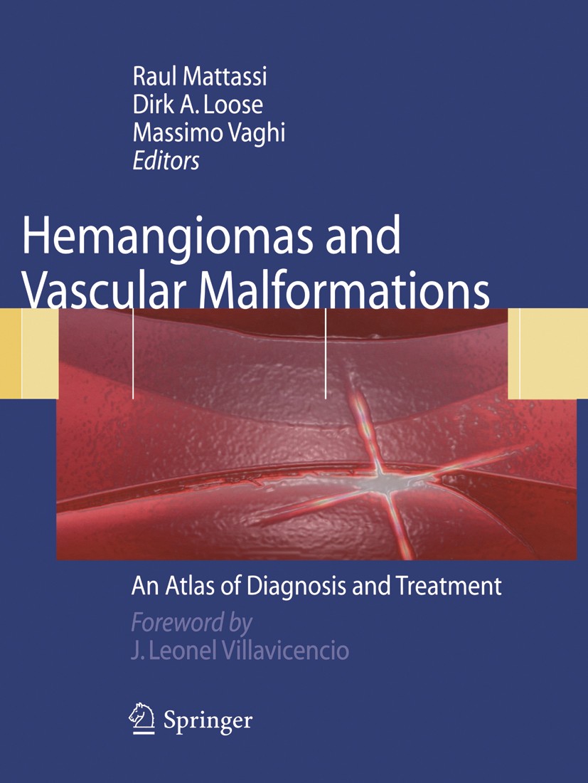 Titlebook: Hemangiomas and Vascular Malformations; An Atlas of Diagnosi Raul Mattassi,Dirk A. Loose,Massimo Vaghi Book 20091st edition Springer-Verlag Titlebook: Hemangiomas and Vascular Malformations; An Atlas of Diagnosi Raul Mattassi,Dirk A. Loose,Massimo Vaghi Book 20091st edition Springer-Verlag