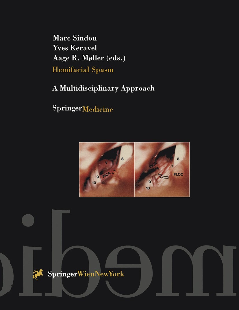 Titlebook: Hemifacial Spasm; A Multidisciplinary Marc Sindou,Yves Keravel,Aage R. Møller Book 1997 Springer-Verlag/Wien 1997 anatomy.brain.brainstem. Titlebook: Hemifacial Spasm; A Multidisciplinary Marc Sindou,Yves Keravel,Aage R. Møller Book 1997 Springer-Verlag/Wien 1997 anatomy.brain.brainstem.