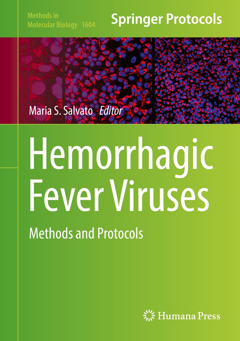 Titlebook: Hemorrhagic Fever Viruses; Methods and Protocol Maria S. Salvato Book 2018 Springer Science+Business Media, LLC, part of Springer Nature 20 Titlebook: Hemorrhagic Fever Viruses; Methods and Protocol Maria S. Salvato Book 2018 Springer Science+Business Media, LLC, part of Springer Nature 20