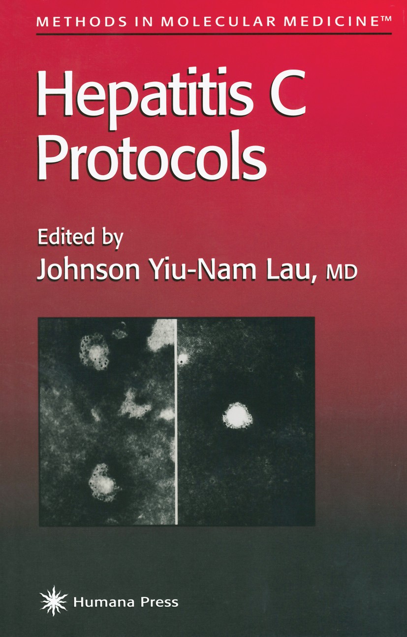 Titlebook: Hepatitis C Protocols; Johnson Yiu-Nam Lau Book 1998 Springer Science+Business Media New York 1998 infectious diseases Titlebook: Hepatitis C Protocols; Johnson Yiu-Nam Lau Book 1998 Springer Science+Business Media New York 1998 infectious diseases
