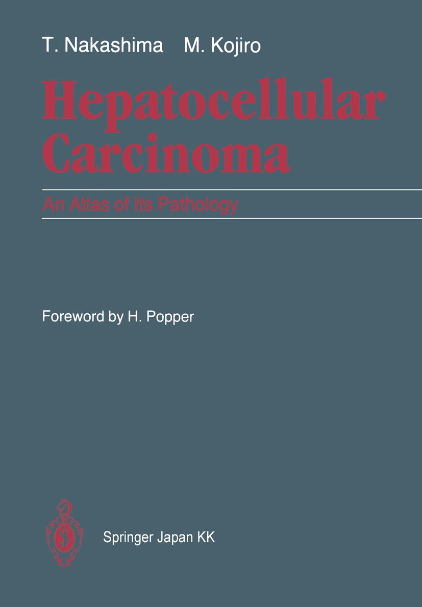 Titlebook: Hepatocellular Carcinoma; An Atlas of Its Path Toshiro Nakashima,Masamichi Kojiro Book 1987 Springer Japan 1987 cancer.carcinoma.hepatocell Titlebook: Hepatocellular Carcinoma; An Atlas of Its Path Toshiro Nakashima,Masamichi Kojiro Book 1987 Springer Japan 1987 cancer.carcinoma.hepatocell