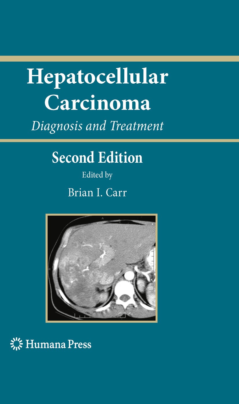 Titlebook: Hepatocellular Carcinoma; Diagnosis and Treatm Brian I. Carr Book 2010Latest edition Humana Press 2010 Carcinom.Cell Cycle Growth Inhibitor Titlebook: Hepatocellular Carcinoma; Diagnosis and Treatm Brian I. Carr Book 2010Latest edition Humana Press 2010 Carcinom.Cell Cycle Growth Inhibitor