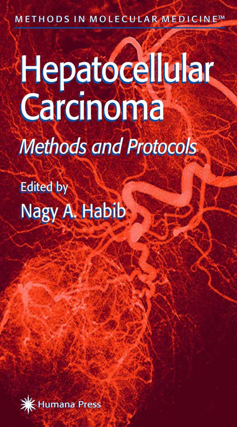 Titlebook: Hepatocellular Carcinoma; Methods and Protocol Nagy A. Habib Book 2000 Springer Science+Business Media New York 2000 Titlebook: Hepatocellular Carcinoma; Methods and Protocol Nagy A. Habib Book 2000 Springer Science+Business Media New York 2000