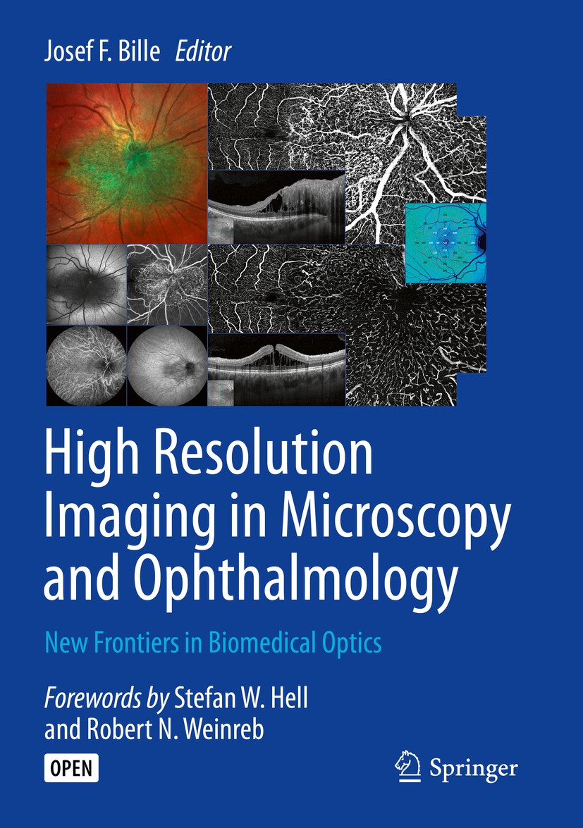Titlebook: High Resolution Imaging in Microscopy and Ophthalmology; New Frontiers in Bio Josef F. Bille Book‘‘‘‘‘‘‘‘ 2019 The Editor(s) (if applicable Titlebook: High Resolution Imaging in Microscopy and Ophthalmology; New Frontiers in Bio Josef F. Bille Book‘‘‘‘‘‘‘‘ 2019 The Editor(s) (if applicable