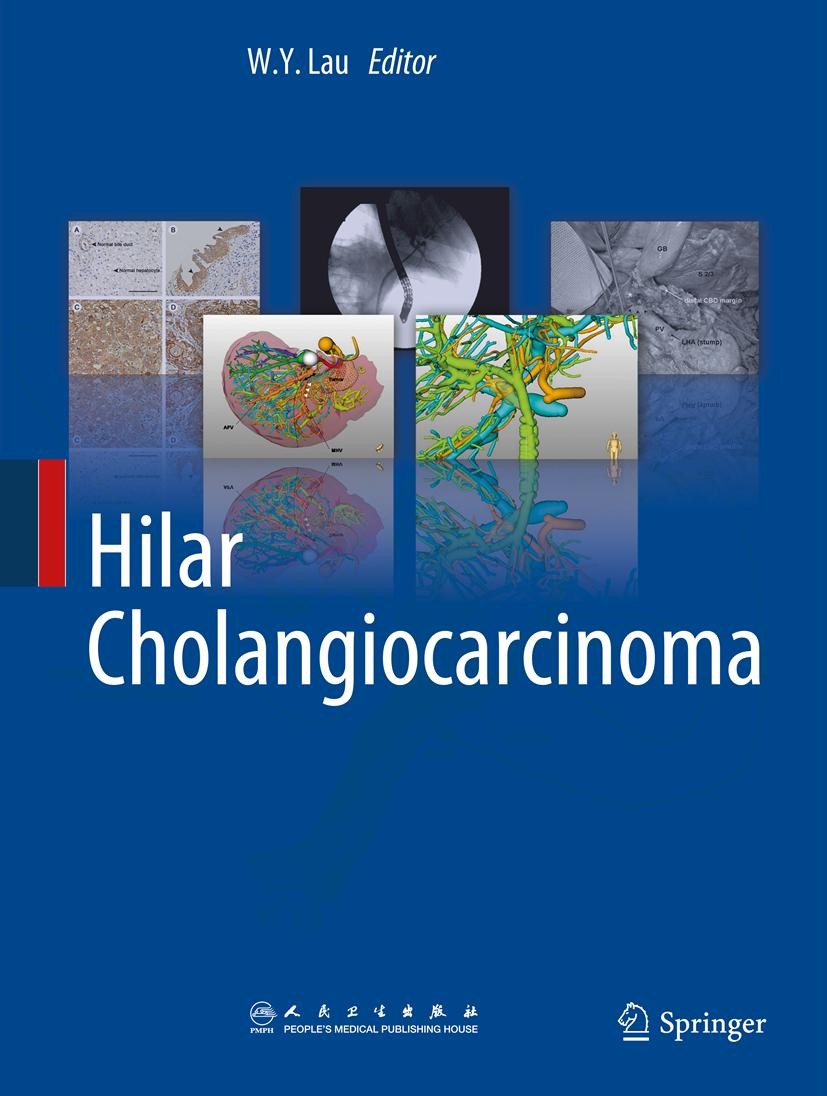 Titlebook: Hilar Cholangiocarcinoma; W.Y. Lau Book 2013 Springer Science+Business Media Dordrecht and People‘s Medical Publishing House 2013 Biliary. Titlebook: Hilar Cholangiocarcinoma; W.Y. Lau Book 2013 Springer Science+Business Media Dordrecht and People‘s Medical Publishing House 2013 Biliary.