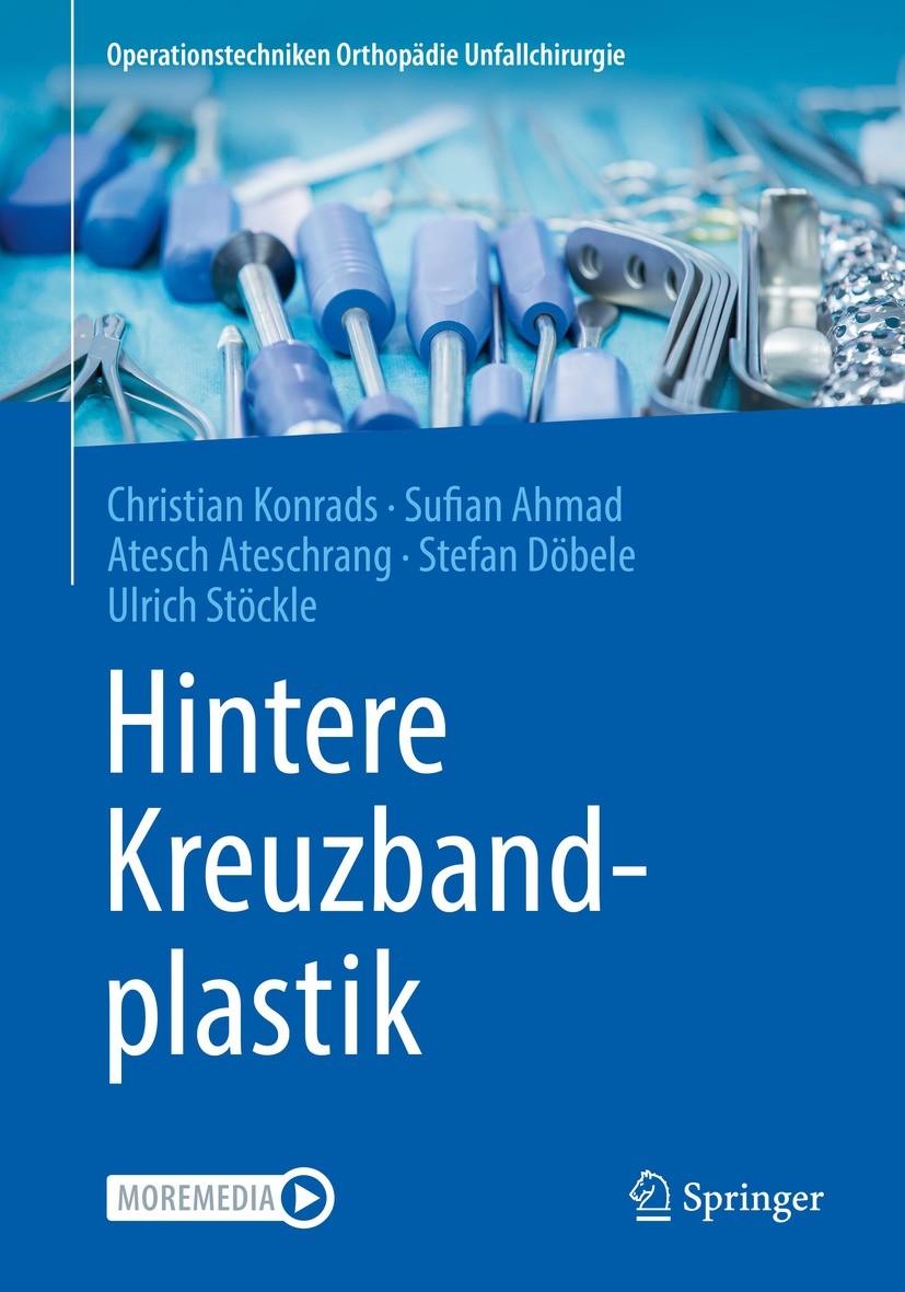 Titlebook: Hintere Kreuzbandplastik; Christian Konrads,Sufian Ahmad,Ulrich Stöckle Book 2020 Der/die Herausgeber bzw. der/die Autor(en), exklusiv liz Titlebook: Hintere Kreuzbandplastik; Christian Konrads,Sufian Ahmad,Ulrich Stöckle Book 2020 Der/die Herausgeber bzw. der/die Autor(en), exklusiv liz