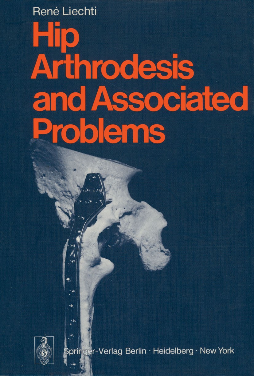 Titlebook: Hip Arthrodesis and Associated Problems; René Liechti Book 1978 Springer-Verlag Berlin Heidelberg 1978 Hüftarthrodese.anatomy.anesthesia.b Titlebook: Hip Arthrodesis and Associated Problems; René Liechti Book 1978 Springer-Verlag Berlin Heidelberg 1978 Hüftarthrodese.anatomy.anesthesia.b