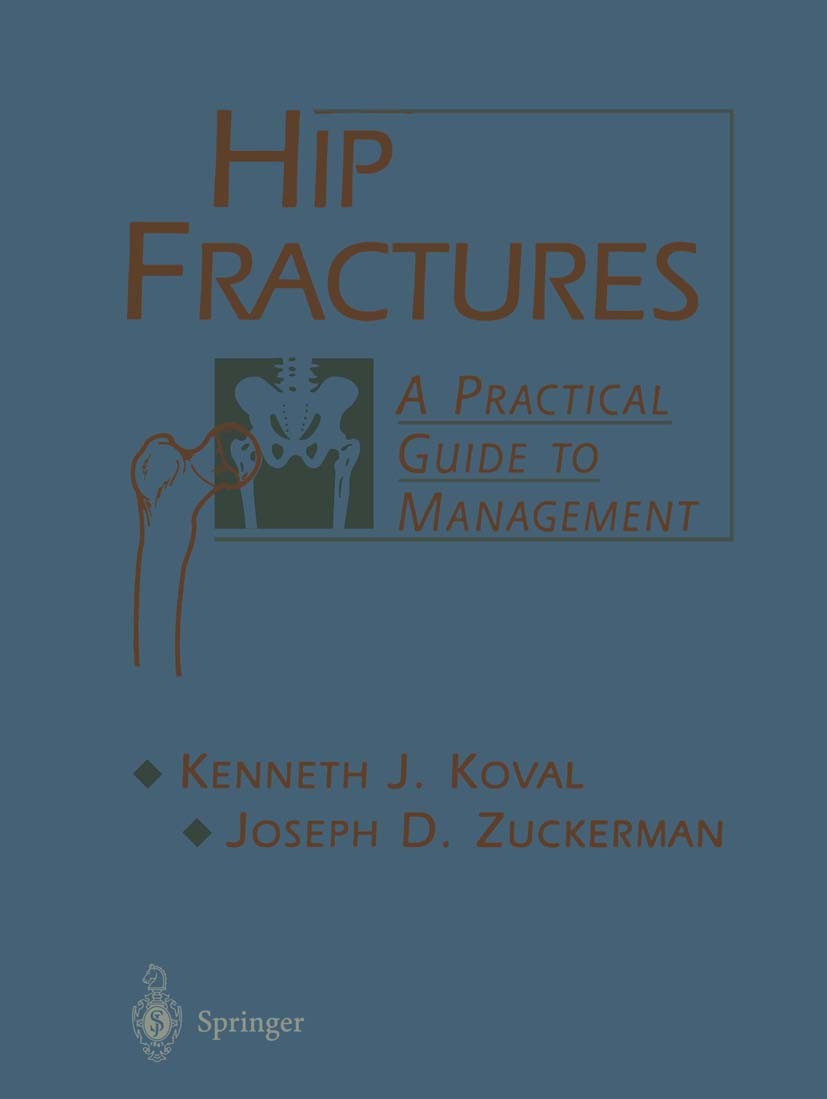 Titlebook: Hip Fractures; A Practical Guide to Kenneth J. Koval,Joseph D. Zuckerman Book 2000 Springer Science+Business Media New York 2000 anatomy.co Titlebook: Hip Fractures; A Practical Guide to Kenneth J. Koval,Joseph D. Zuckerman Book 2000 Springer Science+Business Media New York 2000 anatomy.co