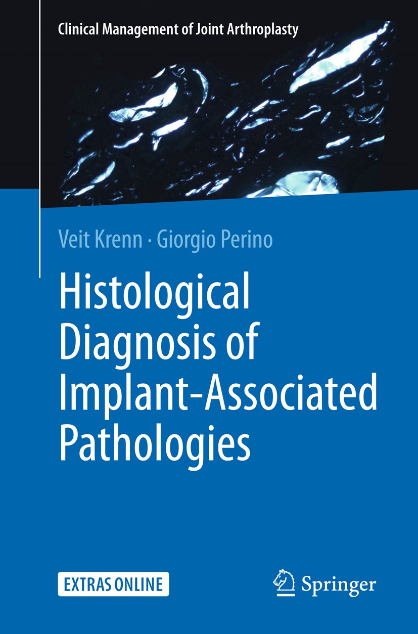 Titlebook: Histological Diagnosis of Implant-associated Pathologies; Veit Krenn,Giorgio Perino Book 2017 Springer-Verlag GmbH Germany 2017 Histologic Titlebook: Histological Diagnosis of Implant-associated Pathologies; Veit Krenn,Giorgio Perino Book 2017 Springer-Verlag GmbH Germany 2017 Histologic