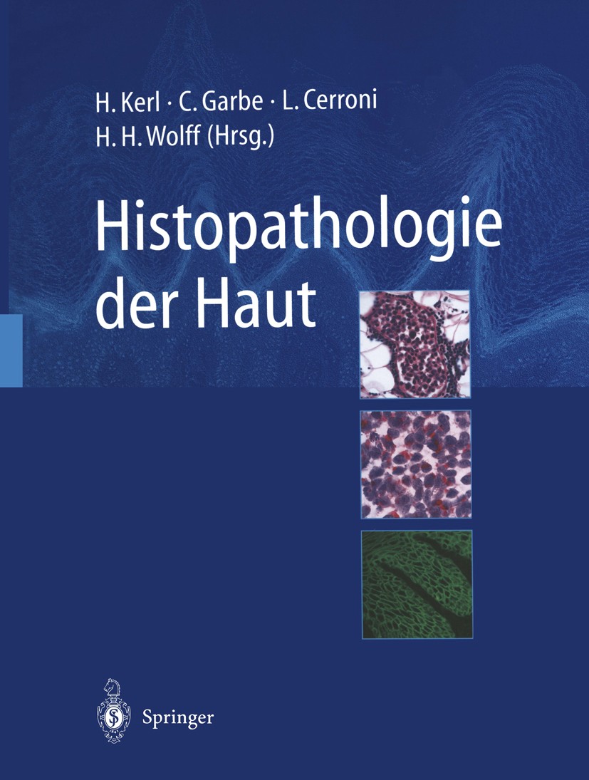 Titlebook: Histopathologie der Haut; Helmut Kerl,Claus Garbe,Helmut H. Wolff Book 20031st edition Springer-Verlag Berlin Heidelberg 2003 Alopezie.Der Titlebook: Histopathologie der Haut; Helmut Kerl,Claus Garbe,Helmut H. Wolff Book 20031st edition Springer-Verlag Berlin Heidelberg 2003 Alopezie.Der