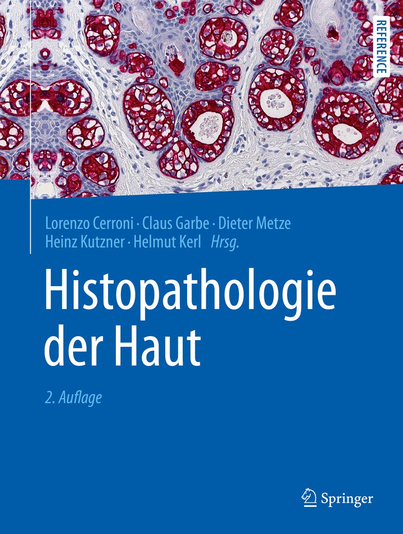 Titlebook: Histopathologie der Haut; Lorenzo Cerroni,Claus Garbe,Helmut Kerl Book 2016Latest edition Springer-Verlag Berlin Heidelberg 2016 Entzündli Titlebook: Histopathologie der Haut; Lorenzo Cerroni,Claus Garbe,Helmut Kerl Book 2016Latest edition Springer-Verlag Berlin Heidelberg 2016 Entzündli