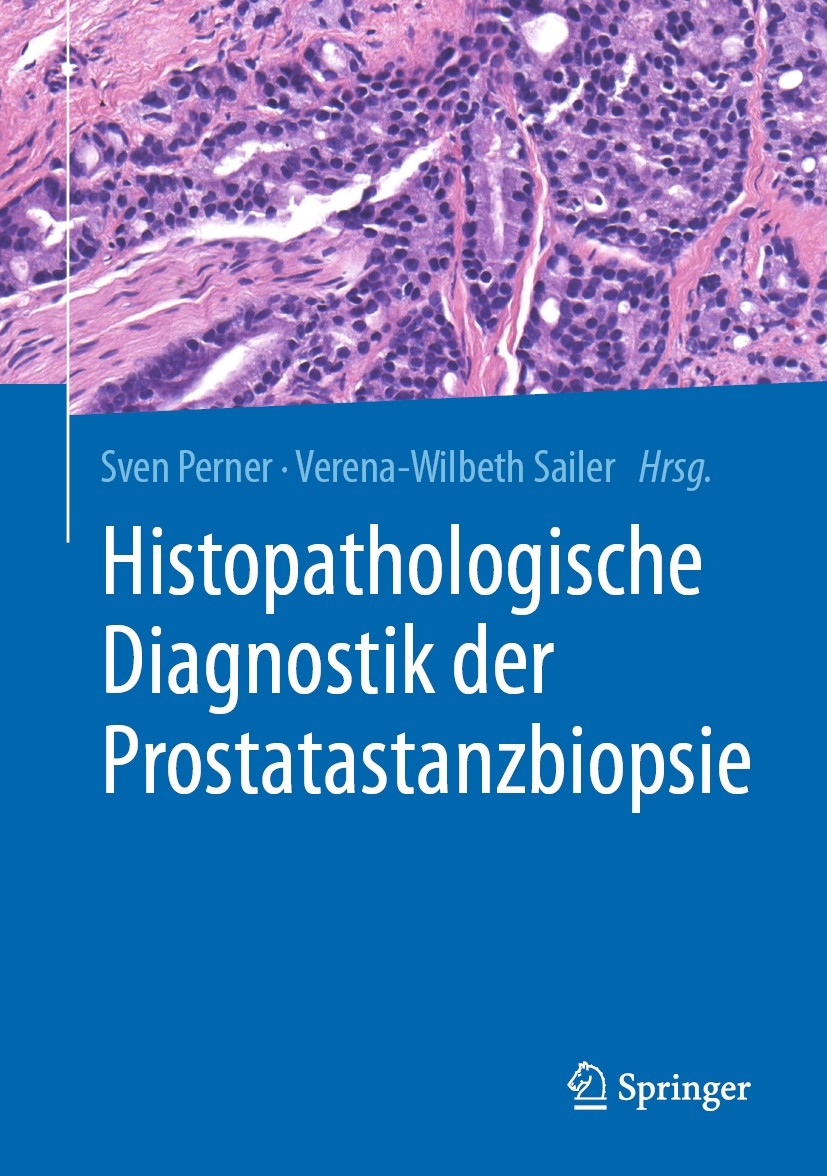 Titlebook: Histopathologische Diagnostik der Prostatastanzbiopsie; Sven Perner,Verena-Wilbeth Sailer Book 2020 Der/die Herausgeber bzw. der/die Autor Titlebook: Histopathologische Diagnostik der Prostatastanzbiopsie; Sven Perner,Verena-Wilbeth Sailer Book 2020 Der/die Herausgeber bzw. der/die Autor