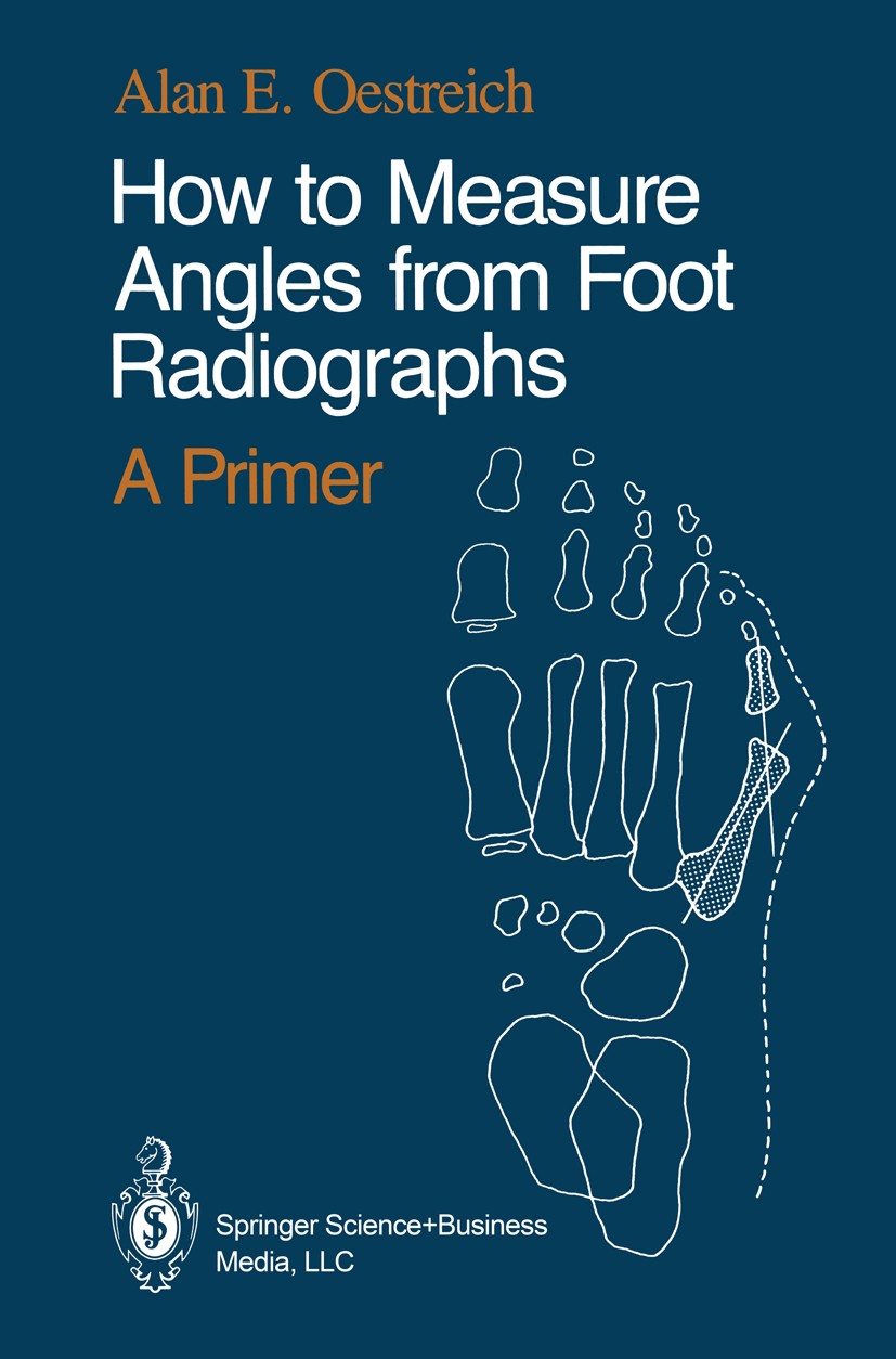 Titlebook: How to Measure Angles from Foot Radiographs; A Primer Alan E. Oestreich Book 1990 Springer Science+Business Media New York 1990 attention.f Titlebook: How to Measure Angles from Foot Radiographs; A Primer Alan E. Oestreich Book 1990 Springer Science+Business Media New York 1990 attention.f