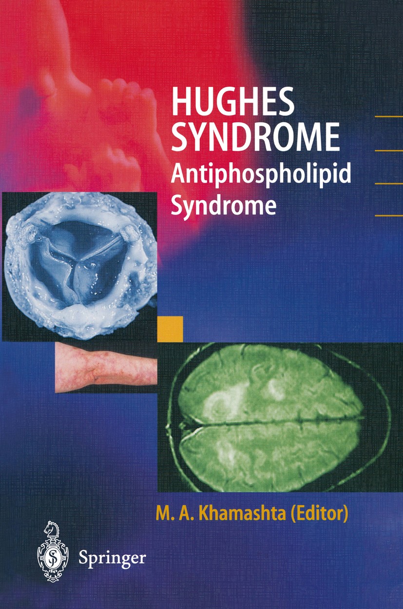 Titlebook: Hughes Syndrome; Antiphospholipid Syn M. A. Khamashta (Deputy Head) Textbook 20001st edition Springer-Verlag London 2000 Antiphospholipid S Titlebook: Hughes Syndrome; Antiphospholipid Syn M. A. Khamashta (Deputy Head) Textbook 20001st edition Springer-Verlag London 2000 Antiphospholipid S