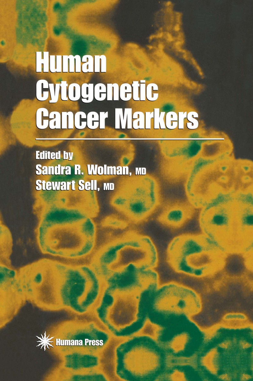 Titlebook: Human Cytogenetic Cancer Markers; Sandra R. Wolman,Stewart Sell Book 1997 Humana Press Inc. 1997 brain tumor.brain tumors.cancer.chromosom Titlebook: Human Cytogenetic Cancer Markers; Sandra R. Wolman,Stewart Sell Book 1997 Humana Press Inc. 1997 brain tumor.brain tumors.cancer.chromosom