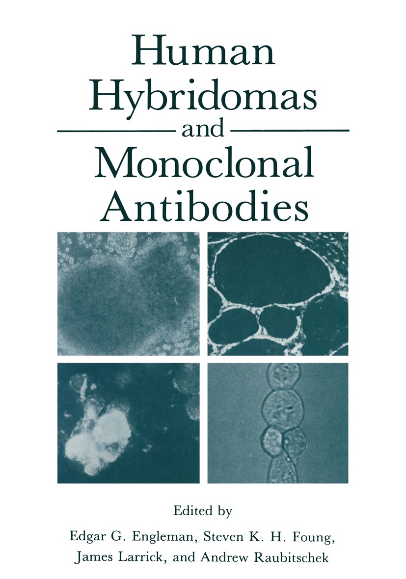 Titlebook: Human Hybridomas and Monoclonal Antibodies; Edgar G. Engleman,Steven K. H. Foung,Andrew A. Rau Book 1985 Plenum Press, New York 1985 antib Titlebook: Human Hybridomas and Monoclonal Antibodies; Edgar G. Engleman,Steven K. H. Foung,Andrew A. Rau Book 1985 Plenum Press, New York 1985 antib