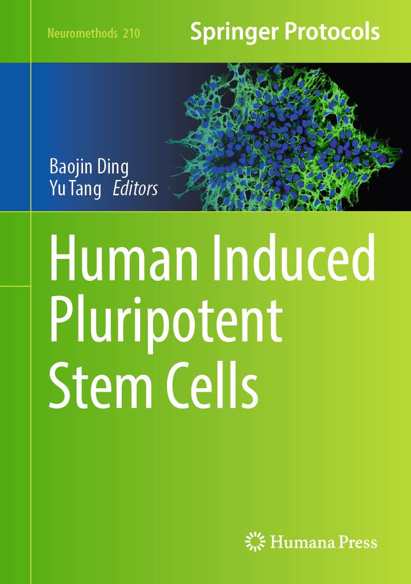 Titlebook: Human Induced Pluripotent Stem Cells; Baojin Ding,Yu Tang Book 2024 The Editor(s) (if applicable) and The Author(s), under exclusive licen Titlebook: Human Induced Pluripotent Stem Cells; Baojin Ding,Yu Tang Book 2024 The Editor(s) (if applicable) and The Author(s), under exclusive licen