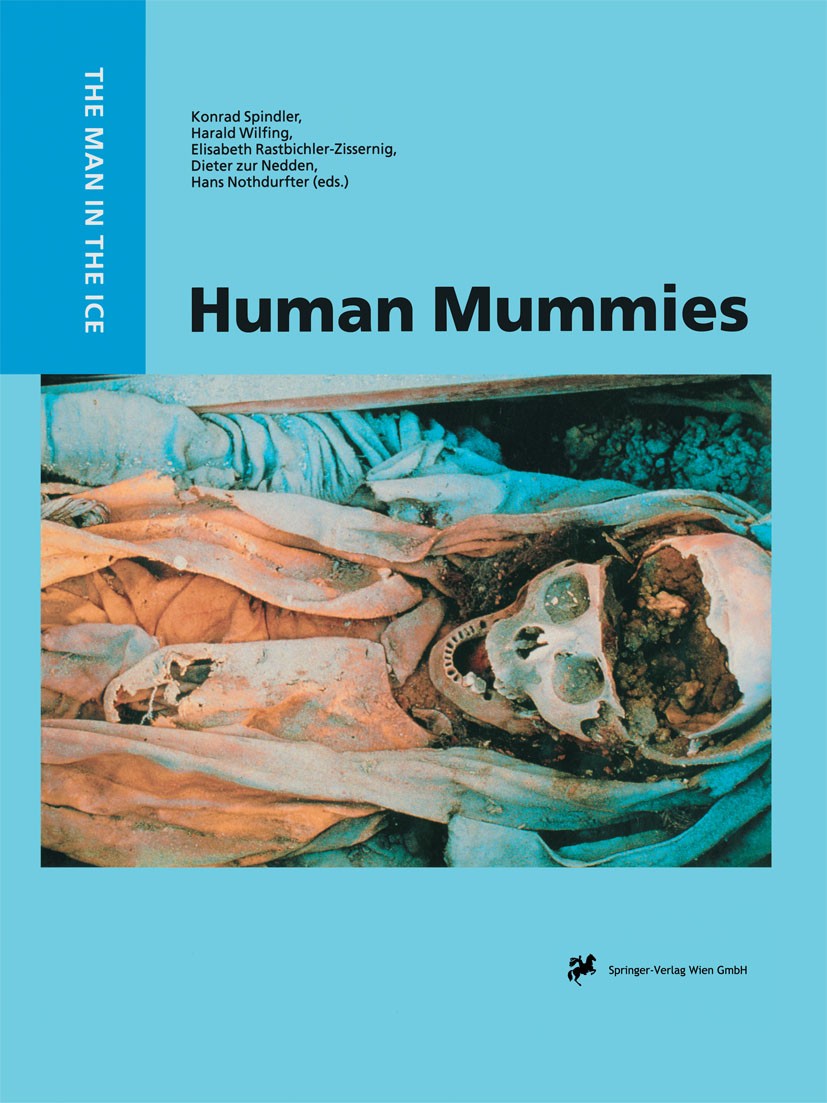 Titlebook: Human Mummies; A Global Survey of t Konrad Spindler,Harald Wilfing,Hans Nothdurfter Conference proceedings 1996 Springer-Verlag Wien 1996 L Titlebook: Human Mummies; A Global Survey of t Konrad Spindler,Harald Wilfing,Hans Nothdurfter Conference proceedings 1996 Springer-Verlag Wien 1996 L