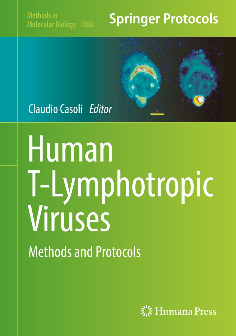 Titlebook: Human T-Lymphotropic Viruses; Methods and Protocol Claudio Casoli Book 2017 Springer Science+Business Media, LLC, part of Springer Nature 2 Titlebook: Human T-Lymphotropic Viruses; Methods and Protocol Claudio Casoli Book 2017 Springer Science+Business Media, LLC, part of Springer Nature 2