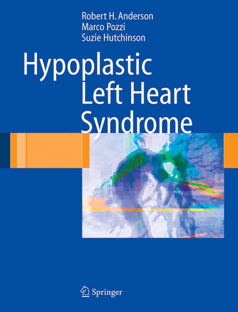 Titlebook: Hypoplastic Left Heart Syndrome; Robert H. Anderson,Marco Pozzi,Suzie Hutchinson Book 2005 Springer-Verlag London 2005 Congenital Heart De Titlebook: Hypoplastic Left Heart Syndrome; Robert H. Anderson,Marco Pozzi,Suzie Hutchinson Book 2005 Springer-Verlag London 2005 Congenital Heart De