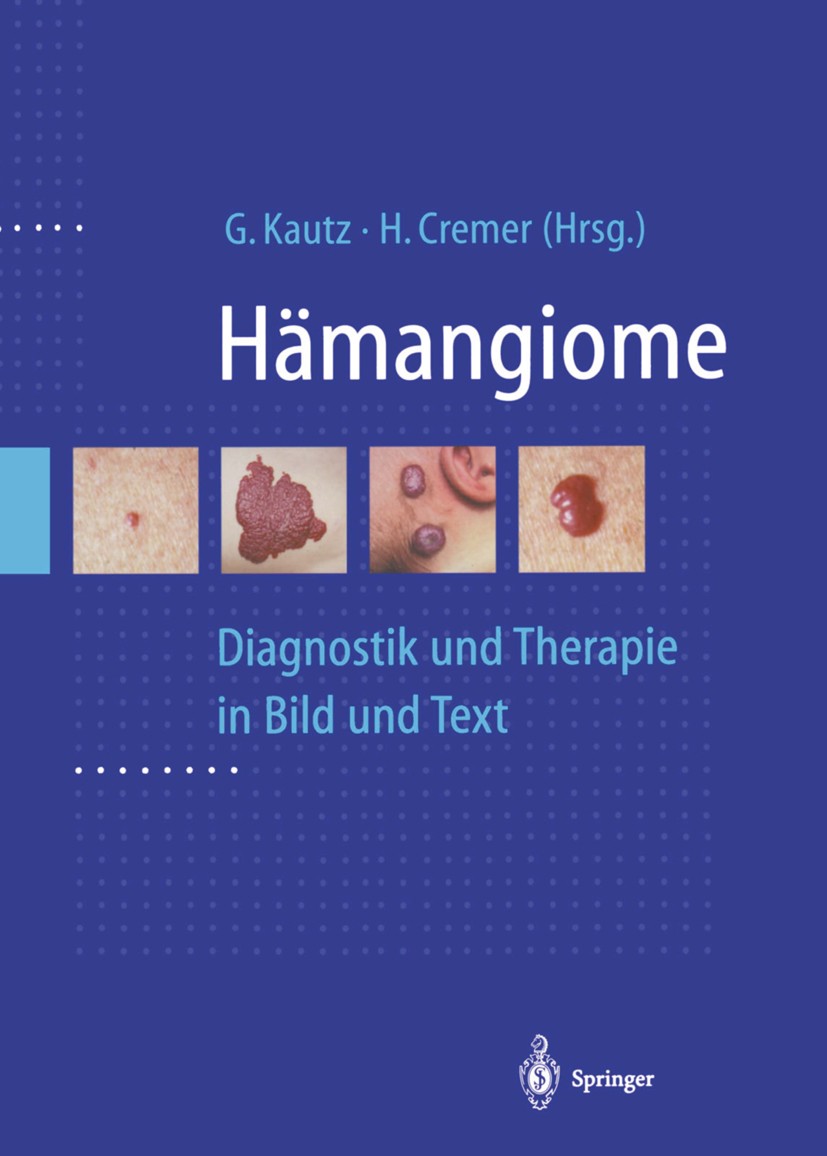 Titlebook: Hämangiome; Diagnostik und Thera G. Kautz,H. Cremer Book 1999 Springer-Verlag Berlin Heidelberg 1999 Angiographie.Behandlung.Diagnose.Diagn Titlebook: Hämangiome; Diagnostik und Thera G. Kautz,H. Cremer Book 1999 Springer-Verlag Berlin Heidelberg 1999 Angiographie.Behandlung.Diagnose.Diagn