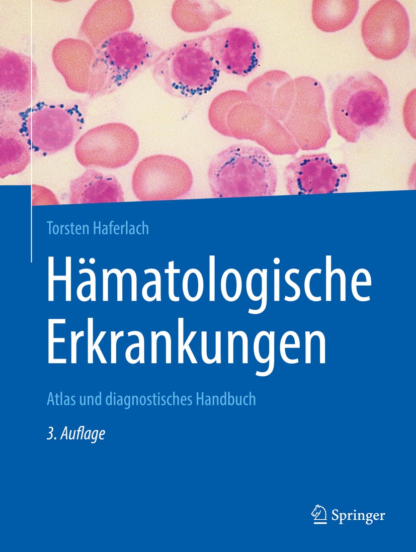 Titlebook: Hämatologische Erkrankungen; Atlas und diagnostis Torsten Haferlach Book 2020Latest edition Springer-Verlag Berlin Heidelberg 2020 Akute Le Titlebook: Hämatologische Erkrankungen; Atlas und diagnostis Torsten Haferlach Book 2020Latest edition Springer-Verlag Berlin Heidelberg 2020 Akute Le