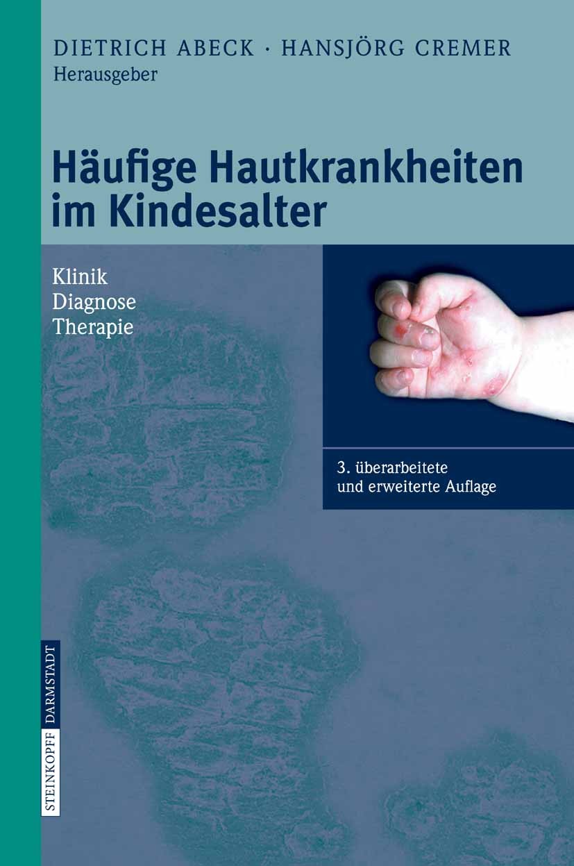 Titlebook: Häufige Hautkrankheiten im Kindesalter; Klinik - Diagnose - Dietrich Abeck,Hansjörg Cremer (ehem. Direktor) Book 20063rd edition Steinkopf Titlebook: Häufige Hautkrankheiten im Kindesalter; Klinik - Diagnose - Dietrich Abeck,Hansjörg Cremer (ehem. Direktor) Book 20063rd edition Steinkopf