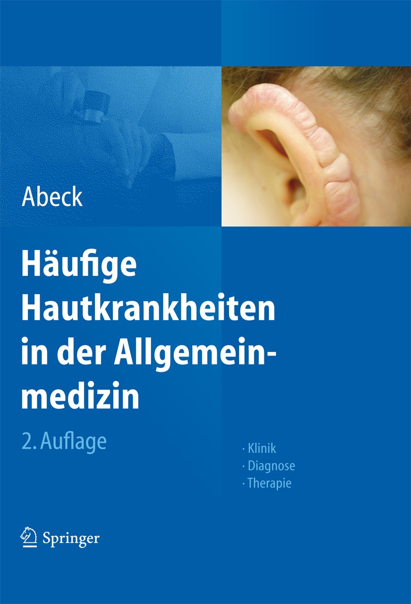 Titlebook: Häufige Hautkrankheiten in der Allgemeinmedizin; Klinik, Diagnose, Th Dietrich Abeck Book 20122nd edition Springer-Verlag Heidelberg 2012 D Titlebook: Häufige Hautkrankheiten in der Allgemeinmedizin; Klinik, Diagnose, Th Dietrich Abeck Book 20122nd edition Springer-Verlag Heidelberg 2012 D