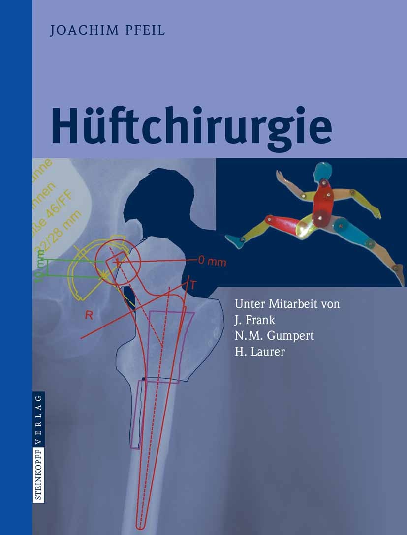 Titlebook: Hüftchirurgie; Joachim Pfeil Book 2008 Steinkopff-Verlag Darmstadt 2008 Arthroskopie.Endoprothetik.Fraktur.Hüftdysplasie.Hüftendoprothetik Titlebook: Hüftchirurgie; Joachim Pfeil Book 2008 Steinkopff-Verlag Darmstadt 2008 Arthroskopie.Endoprothetik.Fraktur.Hüftdysplasie.Hüftendoprothetik