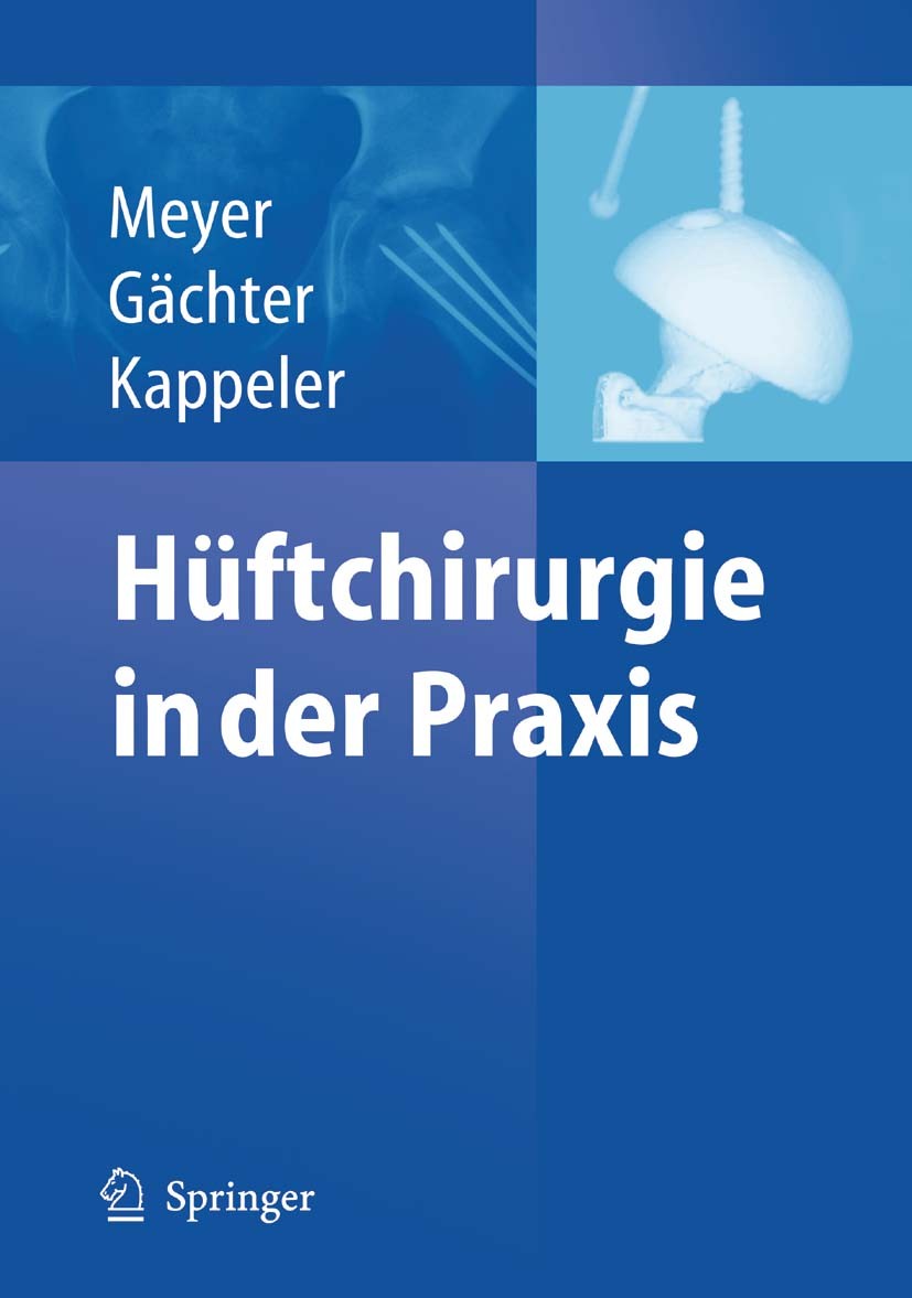 Titlebook: Hüftchirurgie in der Praxis; Rainer-Peter Meyer,André Gächter,U. Kappeler Book 2005 Springer-Verlag Berlin Heidelberg 2005 Arthrose.Arthro Titlebook: Hüftchirurgie in der Praxis; Rainer-Peter Meyer,André Gächter,U. Kappeler Book 2005 Springer-Verlag Berlin Heidelberg 2005 Arthrose.Arthro