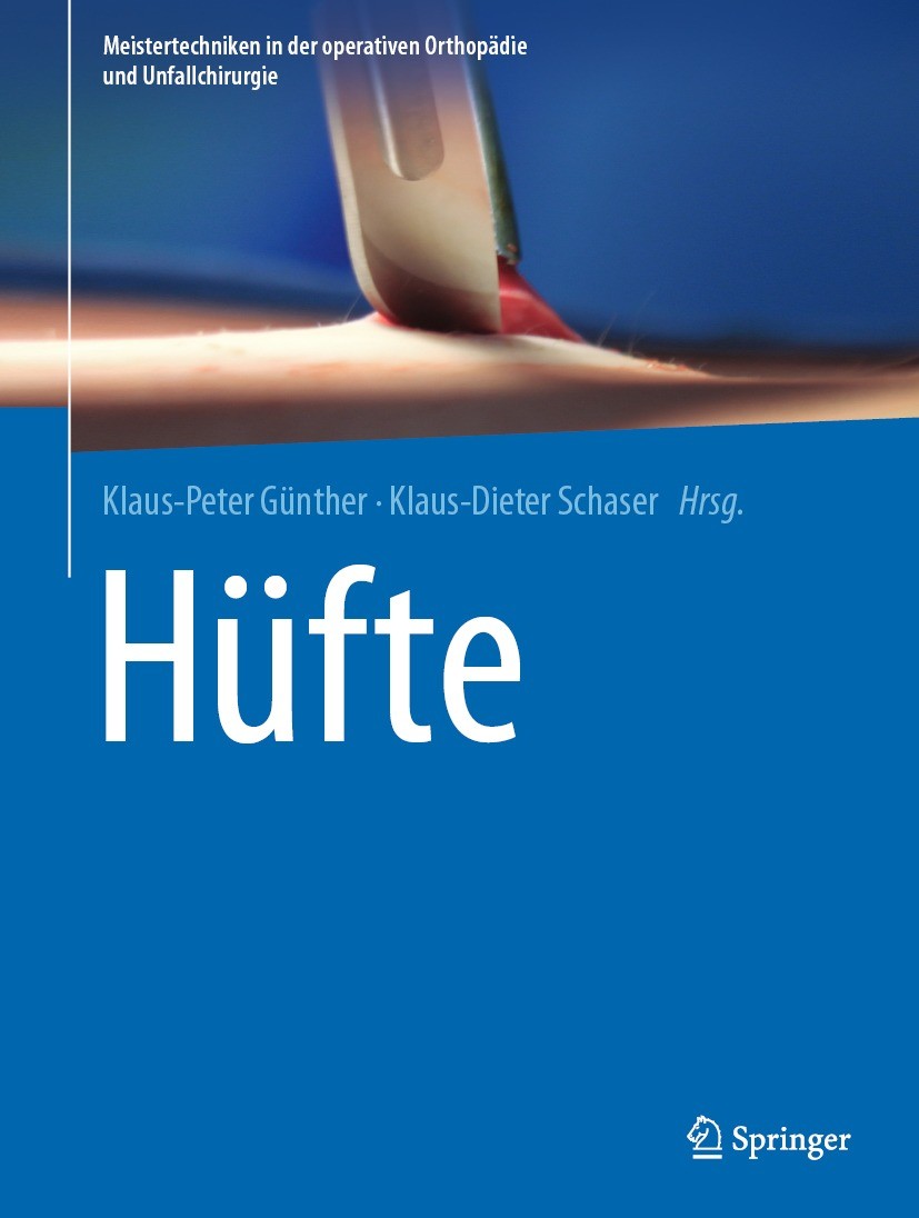 Titlebook: Hüfte; Klaus-Peter Günther,Klaus-Dieter Schaser Book 2021 Springer-Verlag GmbH Deutschland, ein Teil von Springer Nature 2021 Beckenosteot Titlebook: Hüfte; Klaus-Peter Günther,Klaus-Dieter Schaser Book 2021 Springer-Verlag GmbH Deutschland, ein Teil von Springer Nature 2021 Beckenosteot